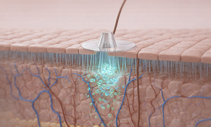 Painless Delivery Beneath Surface