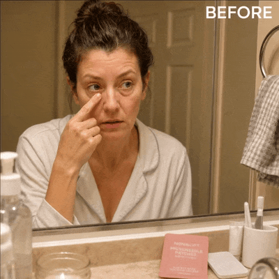 Before and after under-eye transformation