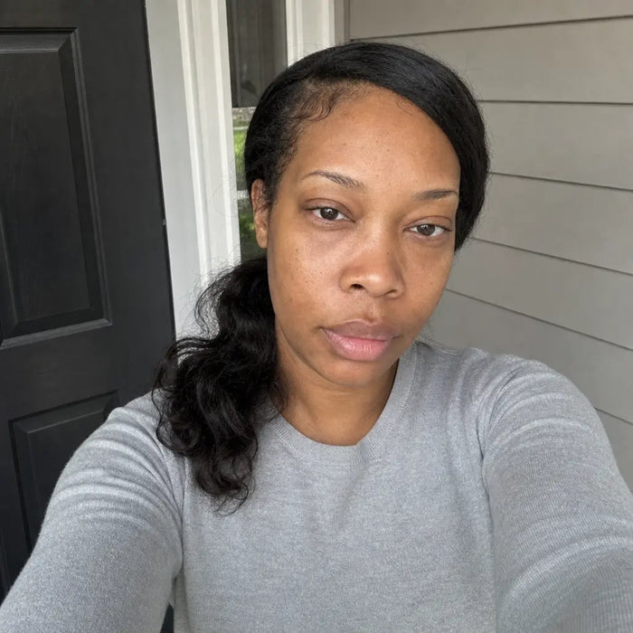 — Michelle T., 39 after