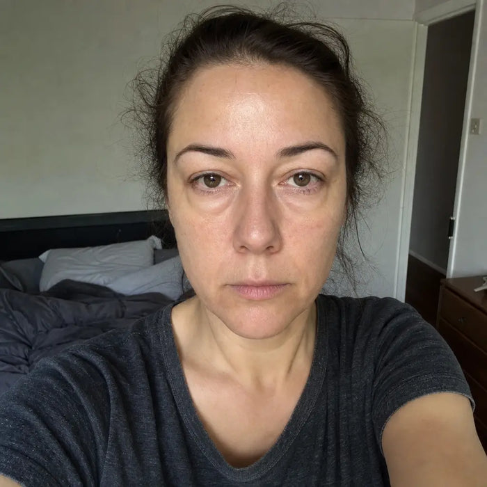 — Amanda K., 41 before