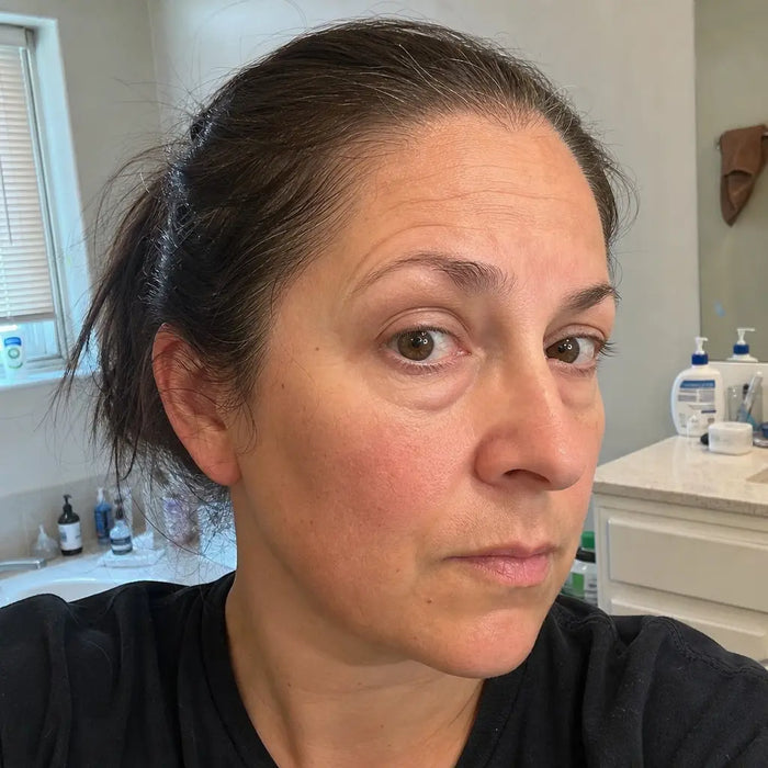 — Jennifer R., 47 before