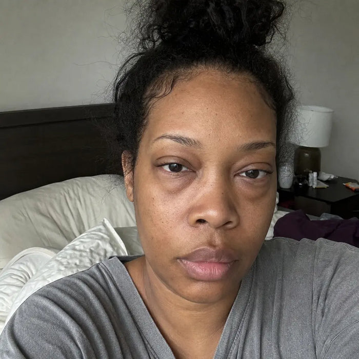 — Michelle T., 39 before