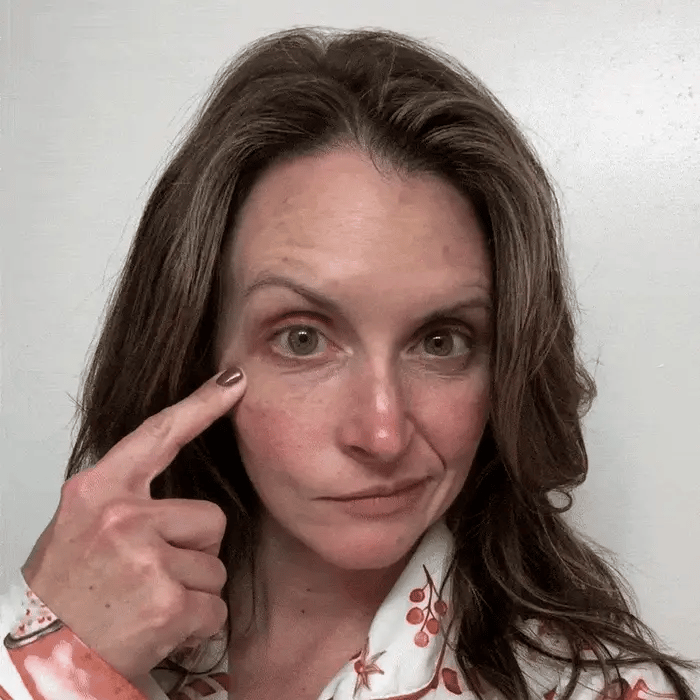 NovaLift microneedling patches in action